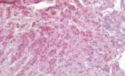 TIAM1 Antibody, Novus Biologicals 50 &mu;g | Buy Online | Bio-Techne | Fisher Scientific